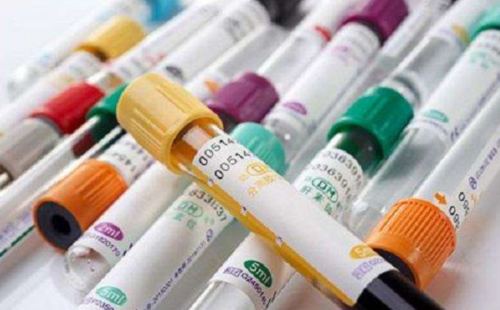 打完胎后多久能同房（顺产后多久可以同房）