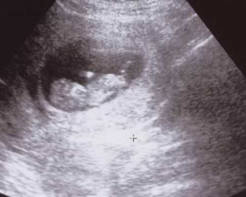 聊城三代试管婴儿的费用大约是多少