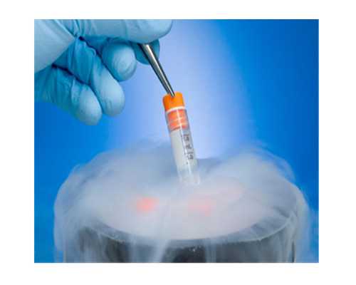 确诊闭经需要做的化验检查有哪些