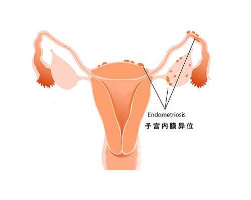 唐山妇幼做试管多少钱费用